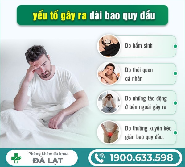 Hình ảnh minh họa